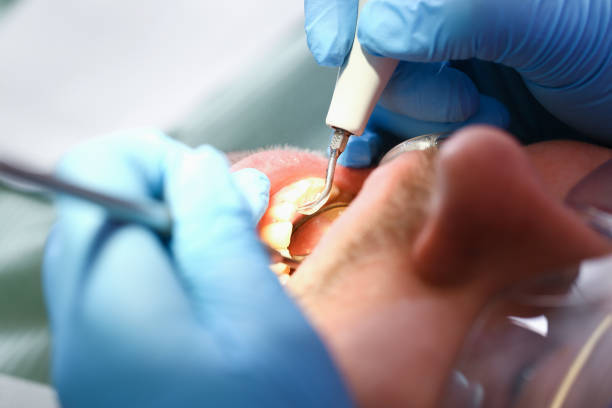 Best Broken or Chipped Tooth Repair in Zelienople, PA