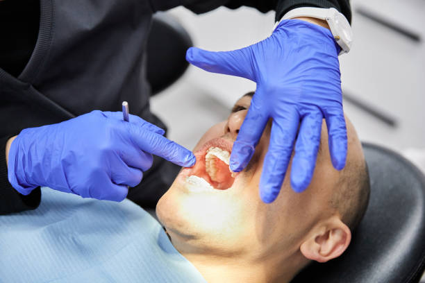 Best Knocked-Out Tooth (Avulsed Tooth) Treatment in Zelienople, PA