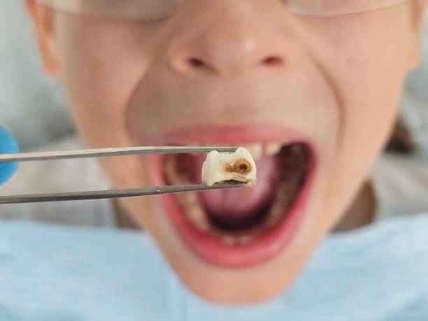 Best Emergency Treatment for Oral Infections in Zelienople, PA